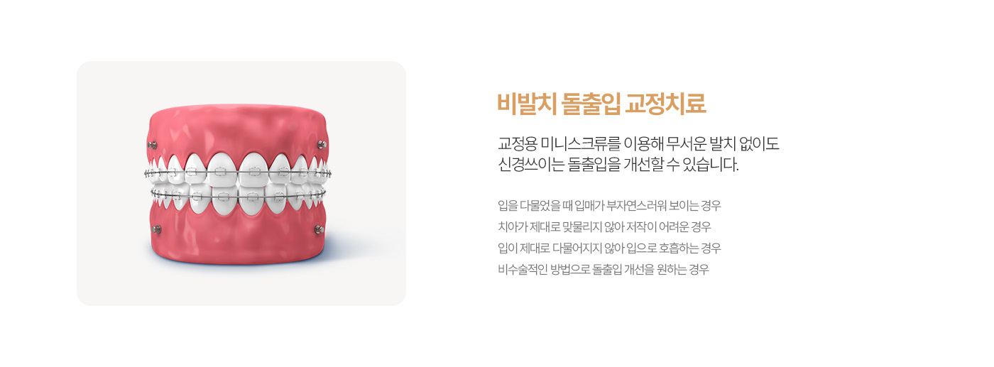더미소교정치과 비발치 돌출입 교정치료