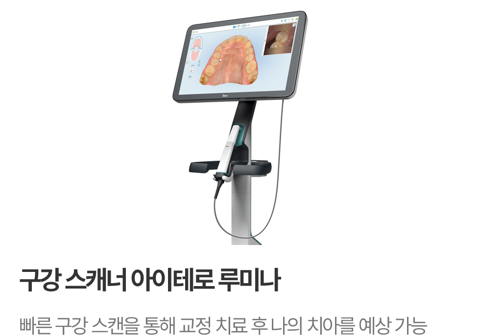 구강 스캐너 아이테로 루미나 빠른 구강 스캔을 통해 교정 치료 후 나의 치아를 예상 가능