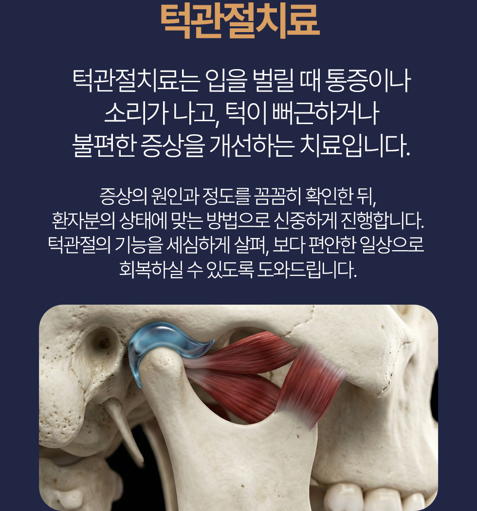 턱관절치료 턱관절치료는 입을 벌릴 때 통증이나 소리가 나고, 턱이 뻐근하거나 불편한 증상을 개선하는 치료입니다. 증상의 원인과 정도를 꼼꼼히 확인한 뒤, 환자분의 상태에 맞는 방법으로 신중하게 진행합니다. 턱관절의 기능을 세심하게 살펴, 보다 편안한 일상으로 회복하실 수 있도록 도와드립니다.